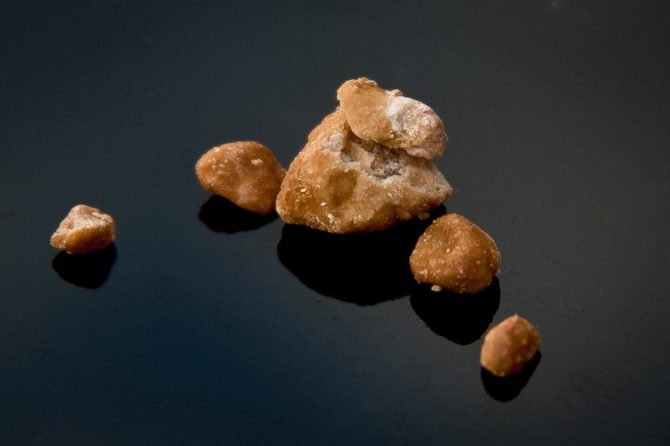 What are the 4 types of kidney stones?