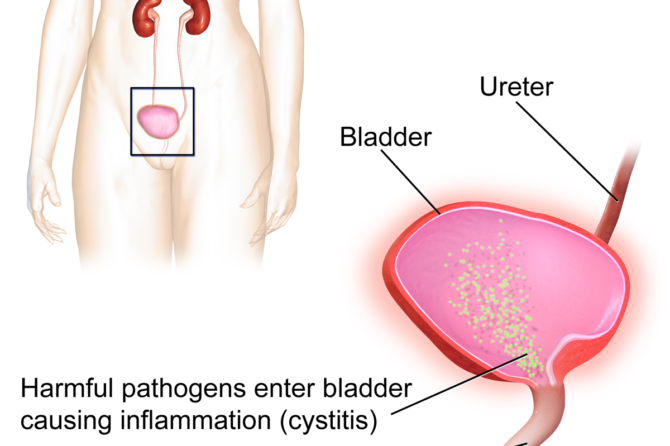 5 Facts You Should Know About the Bladder
